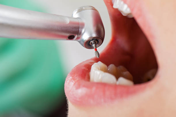 Best Root Canal Emergency Dentist  in Sterling, GA